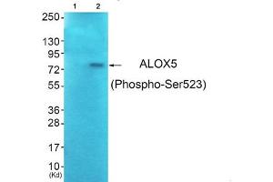 Western blot analysis of extracts from JK cells (Lane 2), using ALOX5 (Phospho-Ser523) Antibody. (ALOX5 anticorps  (pSer523))
