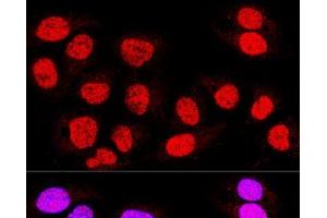 Confocal immunofluorescence analysis of U-2 OS cells using TEAD3 Polyclonal Antibody at dilution of 1:400. (TEAD3 anticorps)