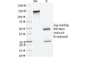 SDS-PAGE Analysis Purified Tryptase Mouse Monoclonal Antibody (TPSAB1/1961). (TPSAB1 anticorps  (AA 115-233))