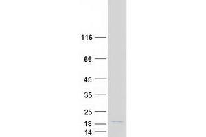 Validation with Western Blot