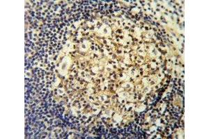 CCR7 antibody IHC analysis in formalin fixed and paraffin embedded human tonsil. (CCR7 anticorps  (AA 11-37))