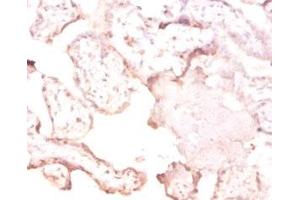 Immunohistochemistry of paraffin-embedded human placenta tissue using ABIN7166803 at dilution of 1:50 (FTSJ1 anticorps  (AA 1-329))