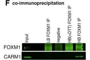 FOXM1 binding at ERα co-bound sites is dependent on ERα.