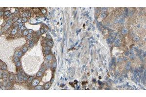 ABIN6278914 at 1/100 staining Human prostate tissue by IHC-P.
