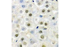 Immunohistochemical analysis of FIP1L1 staining in mouse liver formalin fixed paraffin embedded tissue section.