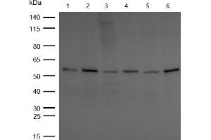 All lanes : CBX2 Rabbit mAb at 1/1k dilution Lane 1 : Hela whole cell lysates Lane 2 : SH-SY5Y whole cell lysates Lane 3 : MCF7 whole cell lysates Lane 4 : 3T3 whole cell lysates Lane 5 : C6 whole cell lysates Lane 6 : Rat Brain lysates Lysates/proteins at 20 μg per lane.