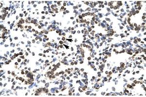 Human Lung; ZNF385 antibody - N-terminal region in Human Lung cells using Immunohistochemistry (ZNF385A anticorps  (N-Term))