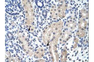 Image no. 1 for anti-Aprataxin (APTX) (C-Term) antibody (ABIN203063)