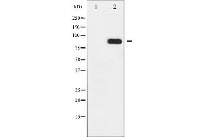 Western blot analysis of IKK- alpha phosphorylation expression in EGF treated MDA-MB-435 whole cell lysates,The lane on the left is treated with the antigen-specific peptide. (IKK alpha anticorps  (pThr23))