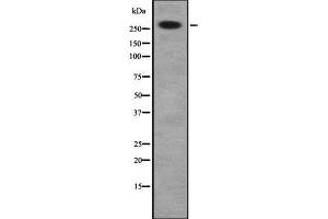 Western blot analysis of DSP using HuvEc whole cell lysates (Desmoplakin anticorps  (C-Term))