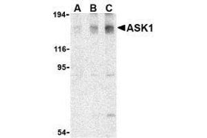 Western blot analysis of ASK1 in SW1353 cell lysate with AP30086PU-N ASK1 antibody at (A) 0. (ASK1 anticorps)