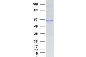 Validation with Western Blot