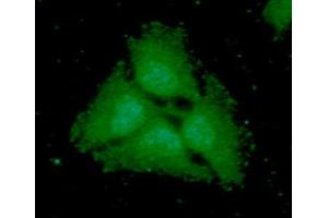 ICC/IF analysis of PARP2 in HeLa cells line, stained with DAPI (Blue) for nucleus staining and monoclonal anti-human PARP2 antibody (1:100) with goat anti-mouse IgG-Alexa fluor 488 conjugate (Green).