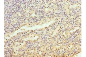 Immunohistochemistry of paraffin-embedded human spleen tissue using ABIN7158640 at dilution of 1:100 (LY86 anticorps  (AA 21-162))