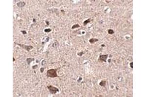 Immunohistochemistry of CCDC134 in human brain tissue with CCDC134 antibody at 2.