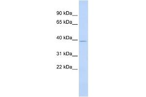 WB Suggested Anti-SAMD8 Antibody Titration: 0. (SAMD8 anticorps  (Middle Region))