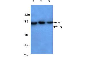 Western blot (WB) analysis of p-PKC ζ antibody at 1/500 dilution (PKC theta anticorps  (pSer676))