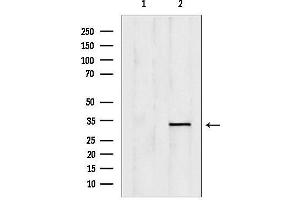 anti-Ovo-Like 1 (OVOL1) (N-Term) antibody