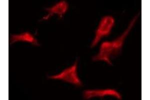 ABIN6276076 staining Hela by IF/ICC. (OR2AJ1 anticorps)