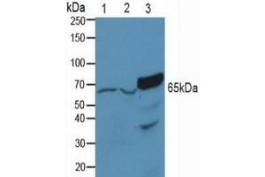 Figure. (PAK1 anticorps  (AA 252-501))