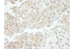 anti-Tyrosyl-DNA Phosphodiesterase 1 (TDP1) (AA 1-50) antibody
