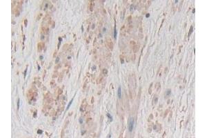 Detection of GKN1 in Human Prostate Tissue using Polyclonal Antibody to Gastrokine 1 (GKN1)
