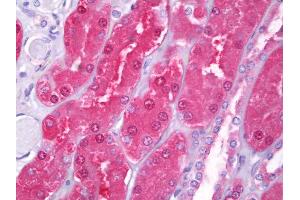 Anti-HIP1 antibody IHC of human kidney, tubules.