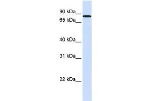 WB Suggested Anti-MAP4K2 Antibody Titration:  0. (MAP4K2 anticorps  (N-Term))