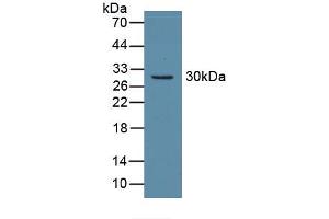 Western blot analysis of recombinant Mouse CA2.