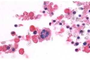 Anti-CD97 antibody  ABIN1048418 IHC staining of human bone marrow. (CD97 anticorps  (Cytoplasmic Domain))