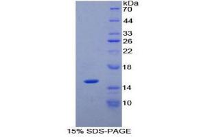 SDS-PAGE (SDS) image for Phospholipase A2-Activating Protein (PLAA) (AA 20-143) protein (His tag) (ABIN1171093)