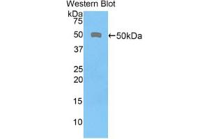 Western blot analysis of the recombinant protein. (CD46 anticorps  (AA 136-341))