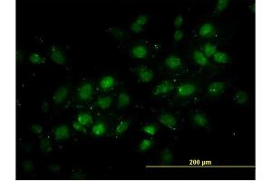 Immunofluorescence of monoclonal antibody to DNMT2 on HeLa cell.
