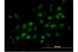 Immunofluorescence of monoclonal antibody to DNMT2 on HeLa cell. (Dnmt2 anticorps  (AA 1-391))