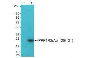 Western blot analysis of extracts from JK cells (Lane 2), using PPP1R2 (Ab-120/121) antiobdy.