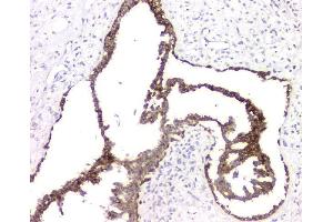 IHC analysis of RMI2 using anti-RMI2 antibody (ABIN6719656). (RMI2 anticorps)