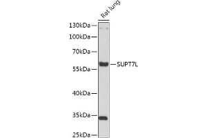 Western blot analysis of extracts of Rat lung, using SUPT7L antibody (ABIN7270646) at 1:1000 dilution. (SUPT7L anticorps  (AA 210-400))