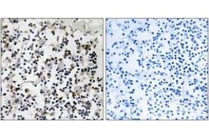 Immunohistochemistry analysis of paraffin-embedded human lymph node tissue, using CLIC4 Antibody. (CLIC4 anticorps  (AA 1-50))