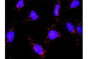 Proximity Ligation Analysis of protein-protein interactions between MAP3K14 and CHUK.