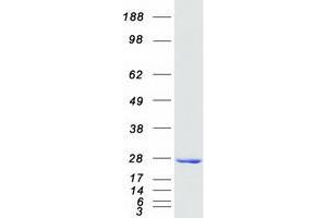 Validation with Western Blot