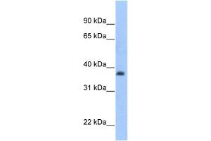 ST3GAL2 antibody used at 1 ug/ml to detect target protein. (ST3GAL2 anticorps  (C-Term))
