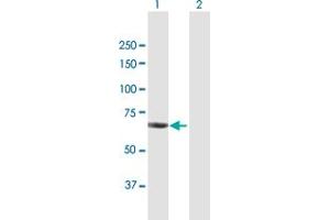 anti-Chromatin Assembly Factor 1, Subunit B (p60) (CHAF1B) (AA 1-559) antibody