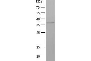 Western Blotting (WB) image for Aldo-keto Reductase Family 1 Member C4 (AKR1C4) (AA 1-343) protein (His-IF2DI Tag) (ABIN7121778)