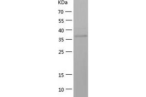 Western Blotting (WB) image for Aldo-keto Reductase Family 1 Member C4 (AKR1C4) (AA 1-343) protein (His tag) (ABIN7285511) (AKR1C4 Protein (AA 1-343) (His tag))
