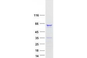 Validation with Western Blot