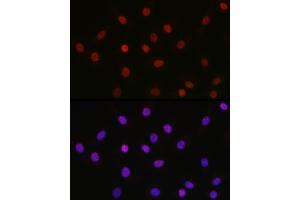 Immunofluorescence analysis of NIH-3T3 cells using [KO Validated] Acetyl-HMGB1-K29 Rabbit pAb (ABIN7267647) at dilution of 1:100 (40x lens).