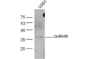 U251 lysates probed with GnRHR Polyclonal Antibody, unconjugated  at 1:300 overnight at 4°C followed by a conjugated secondary antibody at 1:10000 for 60 minutes at 37°C. (GNRHR anticorps  (AA 201-328))