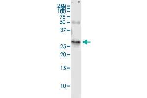 RAB32 (Human) IP-WB Antibody Pair