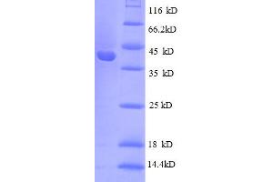 SDS-PAGE (SDS) image for Ribosomal Protein S10 (RPS10) (AA 1-103), (full length) protein (GST tag) (ABIN5712610) (RPS10 Protein (AA 1-103, full length) (GST tag))