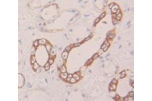Figure. (Mesothelin anticorps  (AA 400-615))